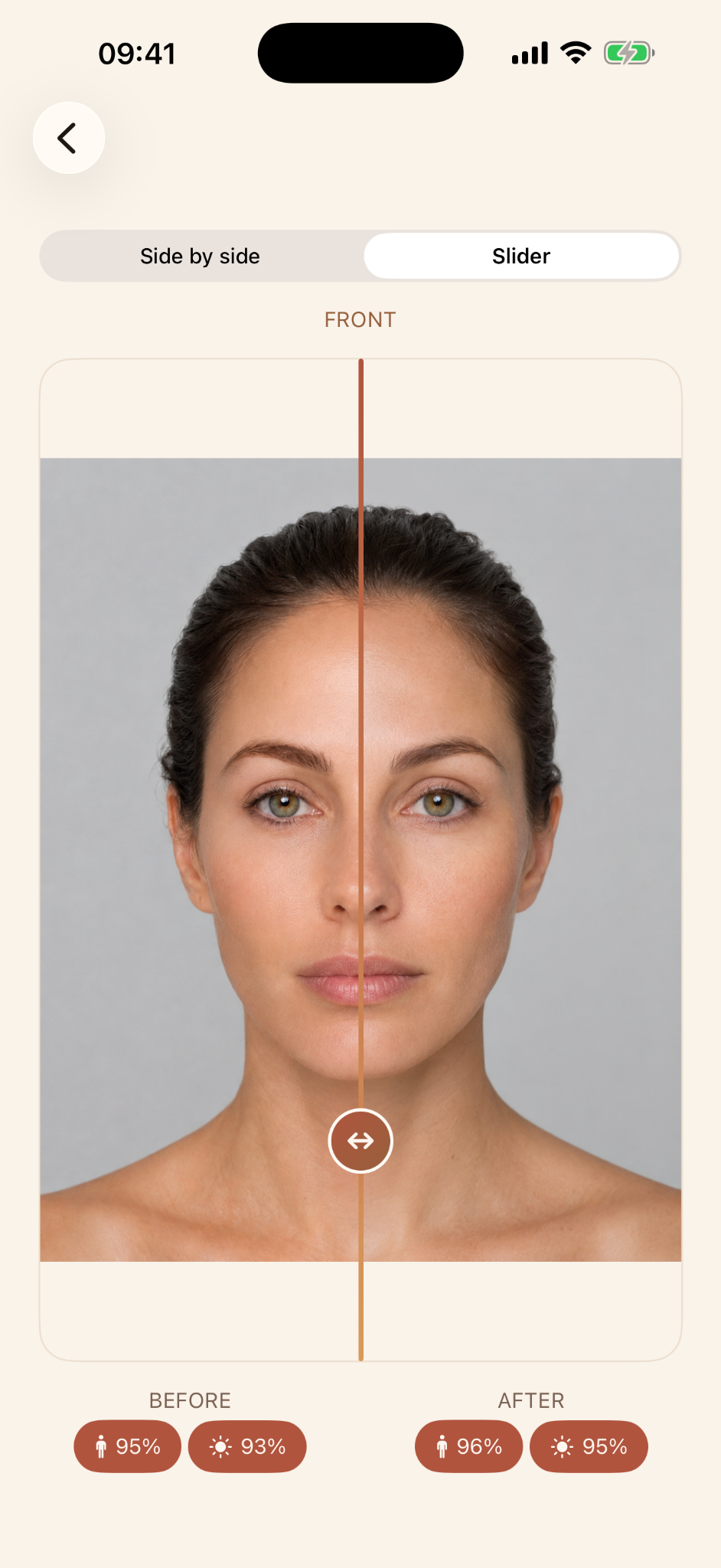 Ruyana before and after comparison slider